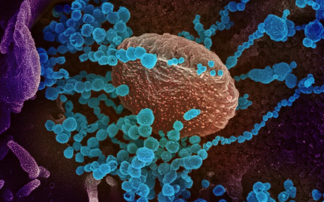 Odborníci zmierňujú paniku ohľadom možnosti koronavírusu ovplyvniť mužskú plodnosť